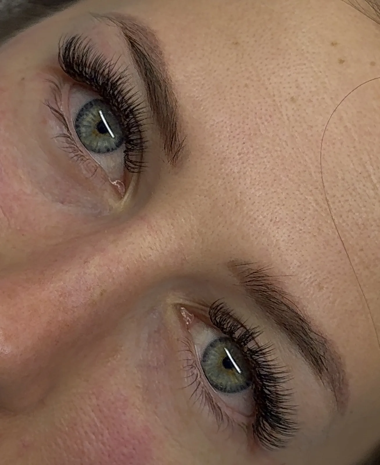 Extension Ciglia
